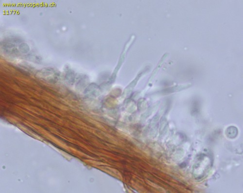 Mensularia nodulosus - Zystiden - 