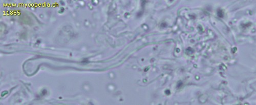 Hyphodontia arguta - Lyozystiden, kopfig - 