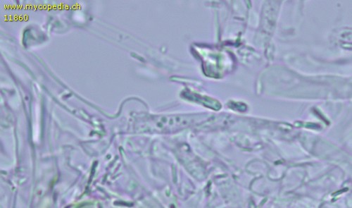 Leptosporomyces mutabilis - Hyphen mit Schnallen - 