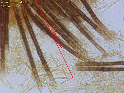 Trichopezizella nidulus - Haare - 