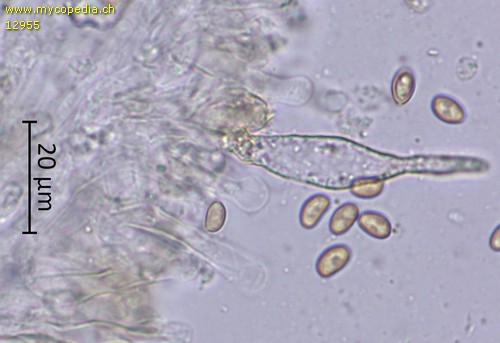 Pholiota gummosa - Chrysozystiden - Wasser  - 