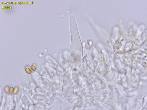 Pholiota elegans - Cheilozystiden - 