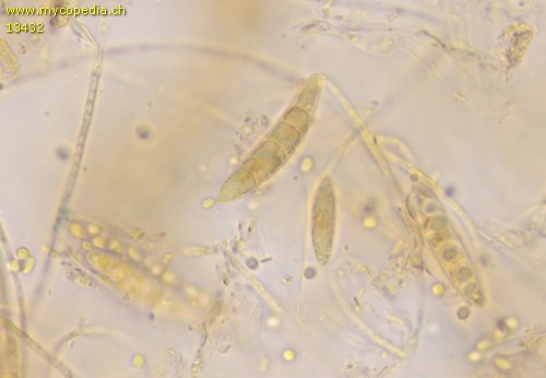 Ascocoryne cylichnium - Sporen - 