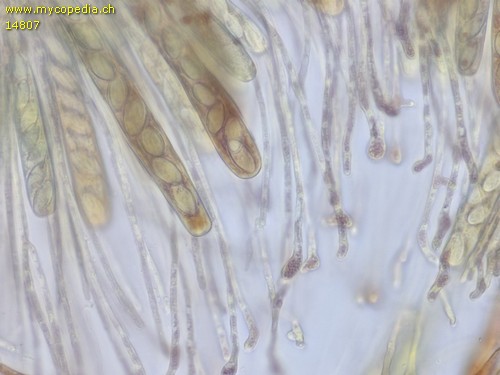 Ascobolus albidus - Paraphysen - 