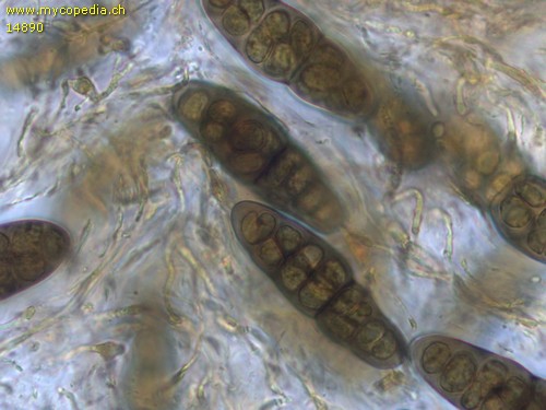 Pleomassaria carpini - Sporen - Wasser  - 