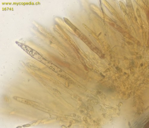 Lachnum virgineum - Paraphysen - Baral  - 