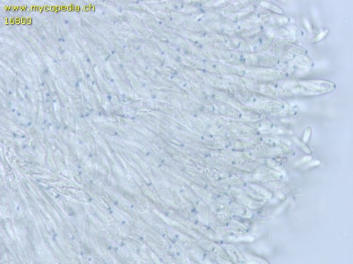 Pyrenopeziza petiolaris - Asci - Baral  - 