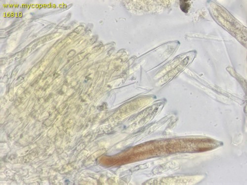 Pyrenopeziza baraliana - Asci - Baral  - 