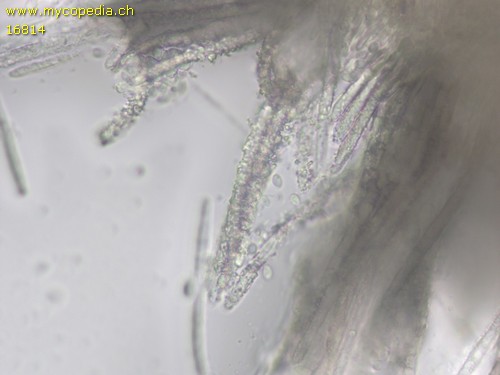 Lachnellula calyciformis - 