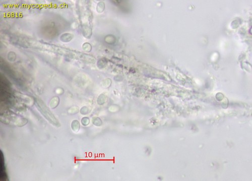 Lachnellula calyciformis - Spore/n - 