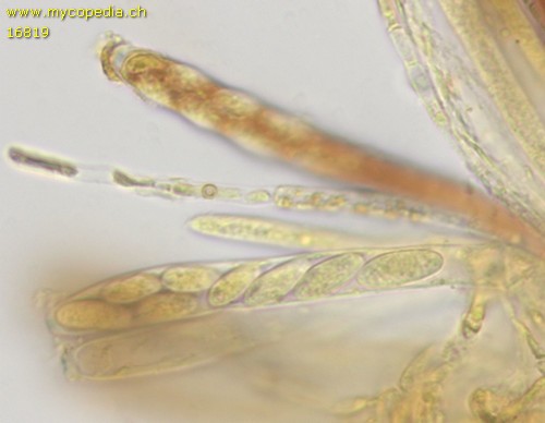 Hymenoscyphus imberbis - Asci - Baral  - 