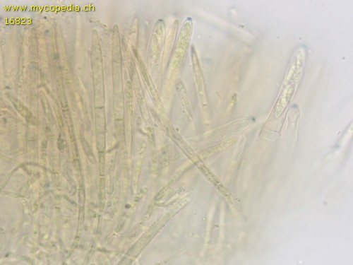 Capitotricha bicolor - 