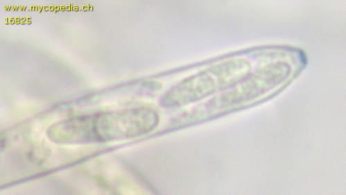 Capitotricha bicolor - 