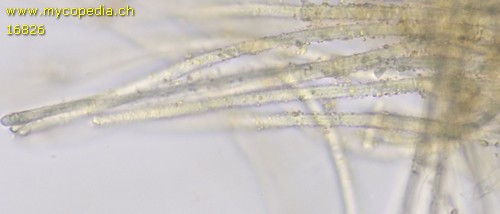 Capitotricha bicolor - Haare - 