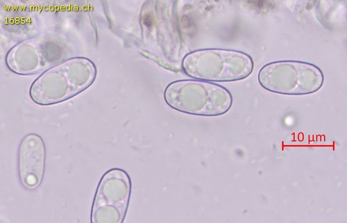 Peziza crassa - Spore/n - Wasser  - 
