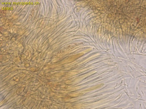 Lophodermium juniperi - Asci & Paraphysen - Baral  - 