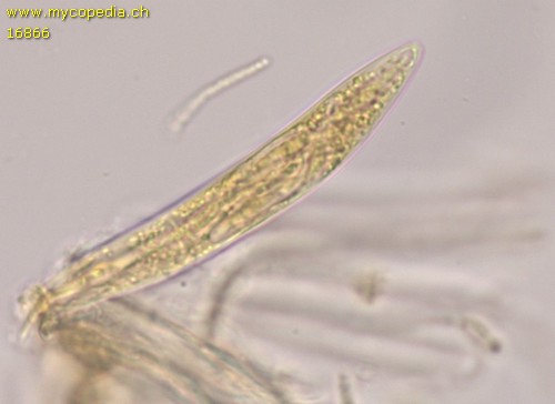 Lophodermium juniperi - Ascus - Baral  - 