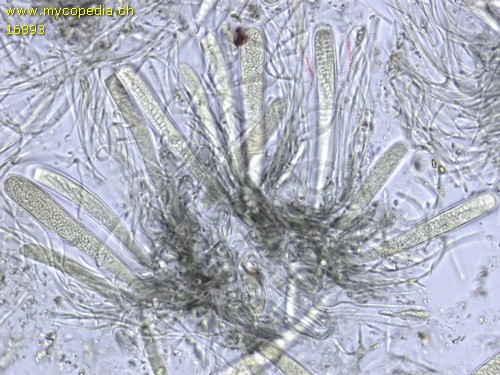 Vexillomyces atrovirens - Asci - 