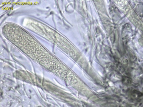 Vexillomyces atrovirens - Ascus - 