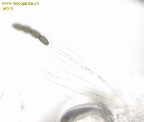 Sporormiella leporina - 