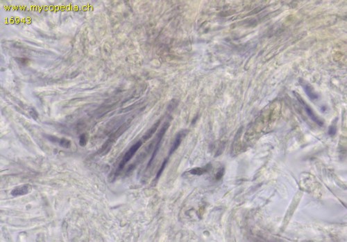 Psilachnum chrysostigmum - Asci - Baral  - 