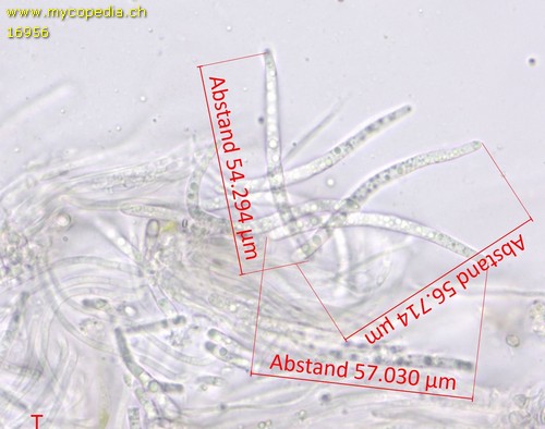 Karstenia idaei - Spore/n - Wasser  - 
