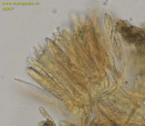 Cistella grevillei - Asci - Baral  - 