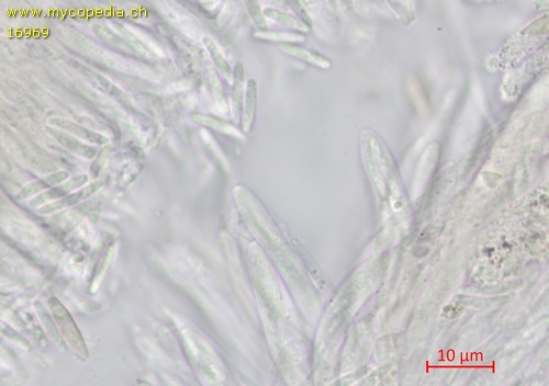 Cistella grevillei - Sporen & Asci - Wasser  - 