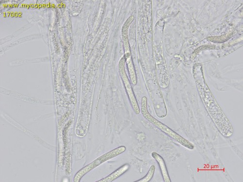 Lasiosphaeria ovina - Spore/n - Wasser  - 