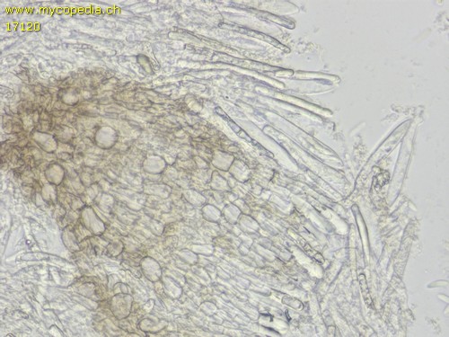 Pyrenopeziza - Excipulum - 