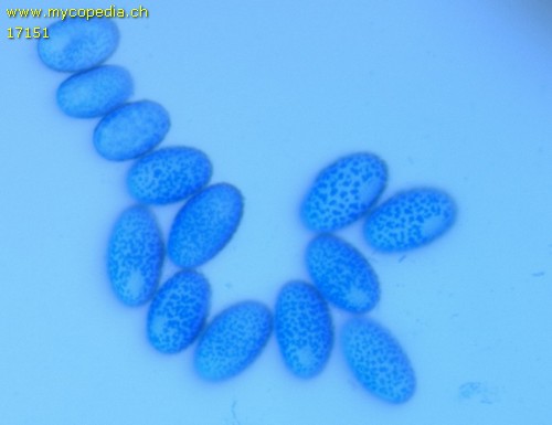 Scutellinia subhirtella - 