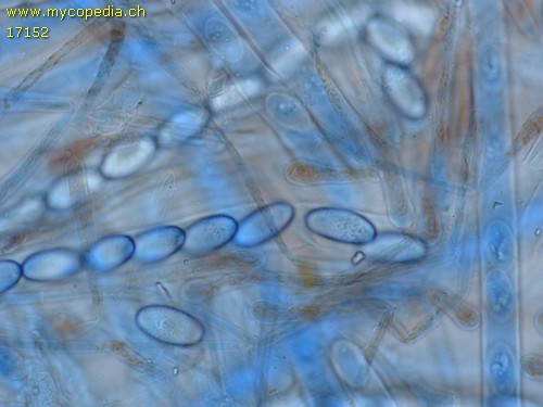Scutellinia heterosculpturata - 