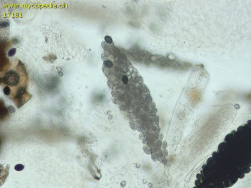 Triangularia setosa - Asci - Wasser  - 