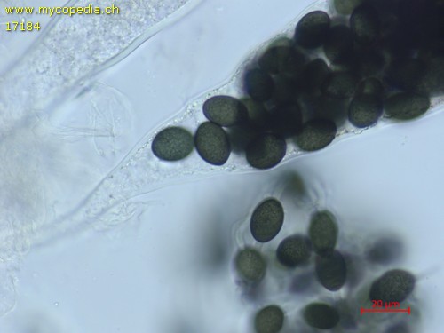 Triangularia setosa - Asci - Wasser  - 
