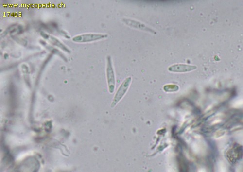 Orbilia alpigena - Spore/n - Wasser  - 
