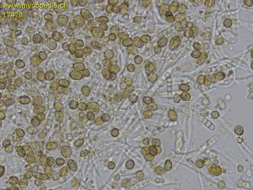 Chaenotheca chrysocephala - Spore/n - Wasser  - 