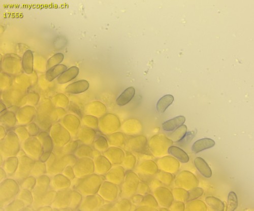 Pistillaria spathulata - Spore/n - Melzers  - 