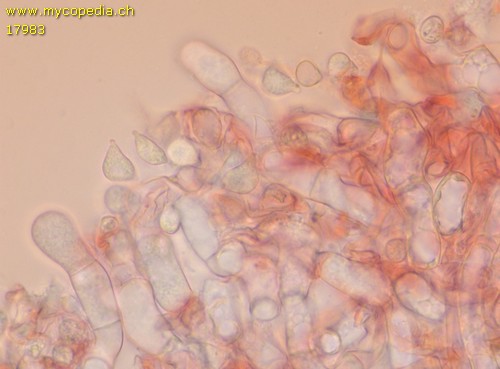 Rhizochontia fusispora - 
