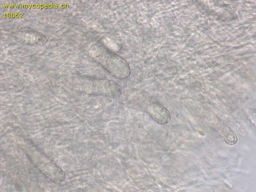 Junghuhnia nitida - Zystiden - 