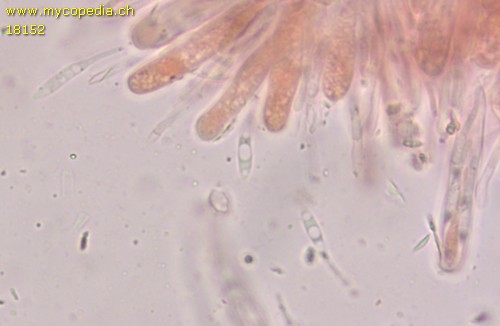 Orbilia aristata - Sporen & Asci - Kongorot  - 