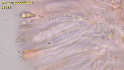 Orbilia aristata - Paraphysen - 