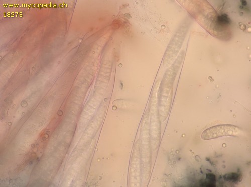 Patellaria atrata - 