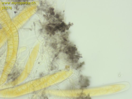Patellaria atrata - 