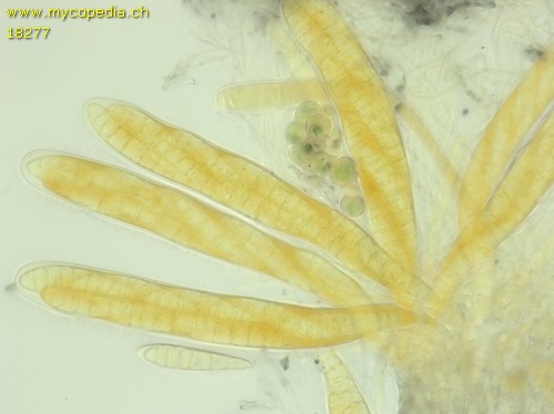 Patellaria atrata - 