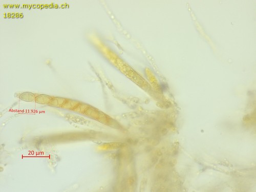 Pyrenomycet 1fach septiert, cf Thyronectria - 