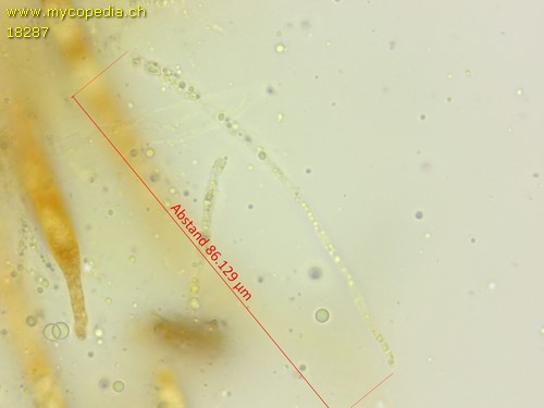 Pyrenomycet 1fach septiert, cf Thyronectria - 
