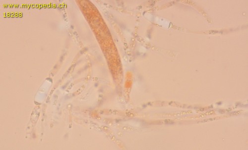 Pyrenomycet 1fach septiert, cf Thyronectria - 