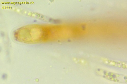 Pyrenomycet 1fach septiert, cf Thyronectria - 