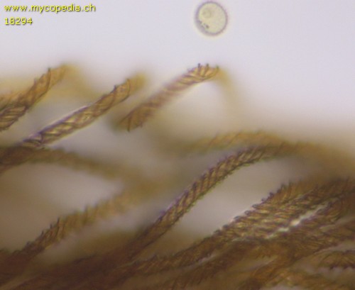 Hemitrichia calyculata - Elateren - 