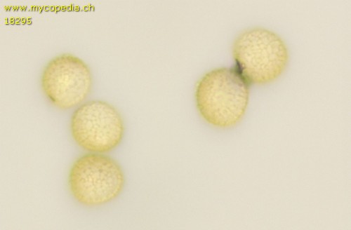 Hemitrichia calyculata - Spore/n - Wasser  - 